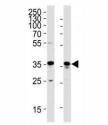 Western blot analysis of lysate from HeLa, HUVEC cell line (left to right) using GAPDH antibody; Ab 
