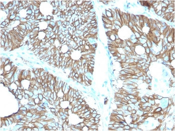 Cadherin 17 Antibody