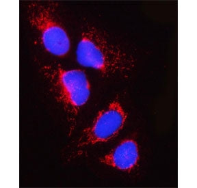 PPM1J Antibody / Protein phosphatase 1J