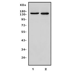 PARP9 Antibody