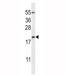 RNASE3 Antibody / Eosinophil cationic protein / Ribonuclease 3