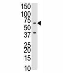 BMPR1B Antibody