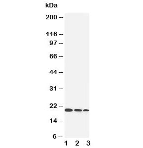 Western blot testing of IL-10 antibody and Lane 1: Recombinant human IL-10 protein 10ng; 2: 5ng; 3: 