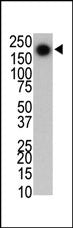 PARK8 Antibody (LRRK2)