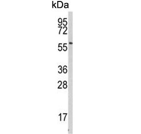 Beta-secretase 1 Antibody / Memapsin-2 / BACE1C