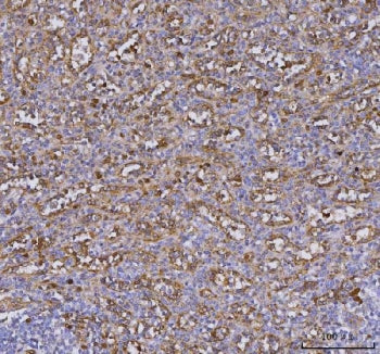 IHC staining of FFPE human spleen tissue with TLR9 antibody. HIER: boil tissue sections in pH8 EDTA 