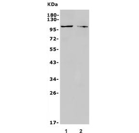 Western blot testing of 1) rat C6 and 2) mouse Neuro-2a antibody with TRPC3 antibody. Predicted mole