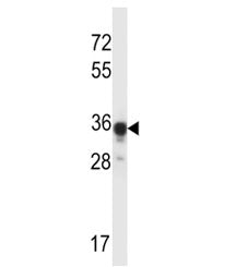 ABHD4 antibody western blot analysis in mouse kidney tissue lysate. Predicted molecular weight ~39 k