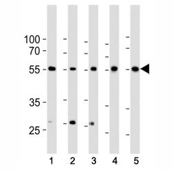 BMPR1A Antibody