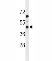 PDGFRL Antibody