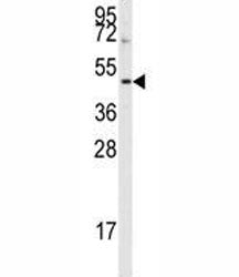 Aurora B Antibody