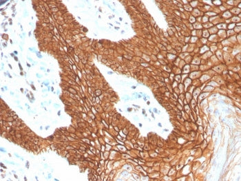 IHC staining of FFPE human cervix with recombinant E-Cadherin antibody (clone CDH1/4398R). HIER: boi