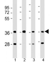 Western blot testing of human 1) 293T/17, 2) liver, 3) HepG2 and 4) SK-BR-3 cell lysate with AKR7A3 