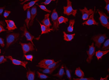 SLC25A1 Antibody / Solute carrier family 25 member 1, 100ug