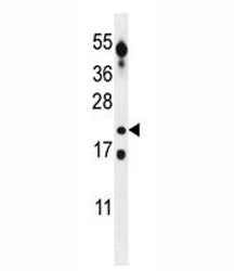 CT45A Antibody