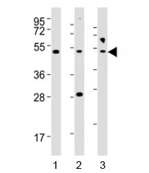 Western blot testing of NFKBIE antibody at 1:2000 dilution; Lane 1: HeLa lysate, 2: Jurkat lysate, 3