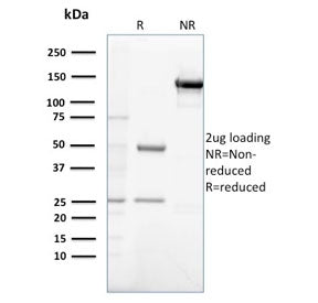 Gastrin Antibody