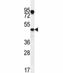 VEGFC Antibody