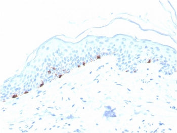 TRP1 / Tyrosinase-Related Protein-1 Antibody