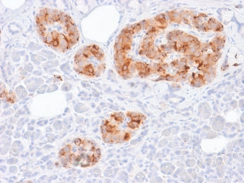 Chromogranin A Antibody