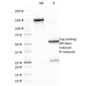 SDS-PAGE analysis of purified, BSA-free Epstein-Barr Virus antibody (clone CS2) as confirmation of i