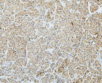 MTR Antibody / Methionine synthase