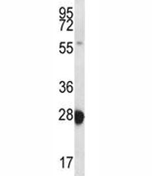 RAB27B Antibody