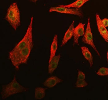 Immunofluorescent staining of FFPE human A549 cells with Cdk2 antibody (green) and Beta Tubulin mAb 