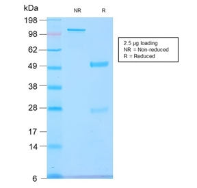 SDS-PAGE analysis of purified, BSA-free recombinant GNRHR / LHCGR antibody (clone GNRHR/2982R) as co