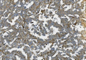 K-Cadherin Antibody / CDH6