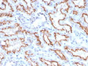 IHC staining of FFPE human kidney with recombinant Interferon gamma antibody (clone IFNG/3996R). HIE