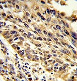 TRIP13 Antibody / PCH2