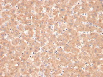 IHC staining of FFPE human liver with Factor VII antibody. HIER: boil tissue sections in pH 9 10mM T