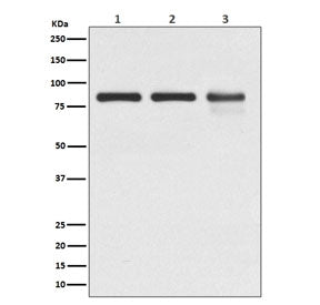 Western blot testing of 1) human A431, 2) mouse NIH3T3 and 3) rat C6 cell lysate with Gamma Catenin 