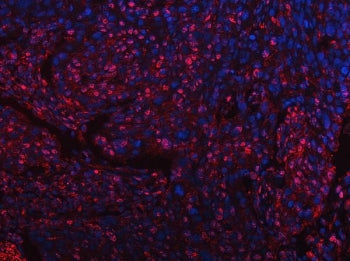 SART3 Antibody / Tip110
