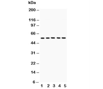 GLUT4 Antibody (Glucose Transporter 4)