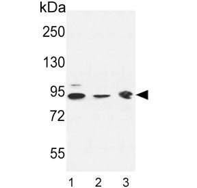 DNAJC6 Antibody