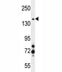 MET Antibody