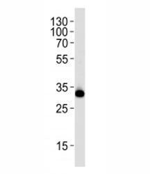 RPS6 Antibody