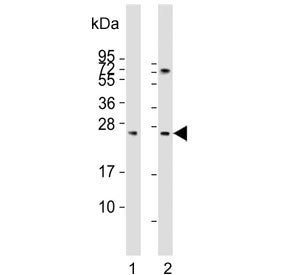 Western blot testing of human 1) kidney and 2) liver lysate with Sclerostin antibody. Predicted mole