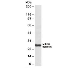 Western blot testing of human skin lysate with PMEL17 antibody at 1ug/ml. Predicted molecular weight