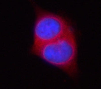 PSAT1 Antibody / Phosphoserine aminotransferase