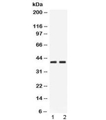 Western blot testing of 1) rat pancreas and 2) human HeLa lysate with PSAT1 antibody at 0.5ug/ml. Pr