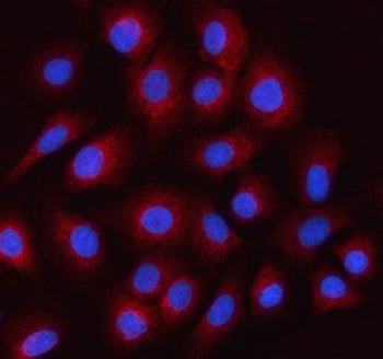 STRADB Antibody / Als2Cr2 / ILPIP