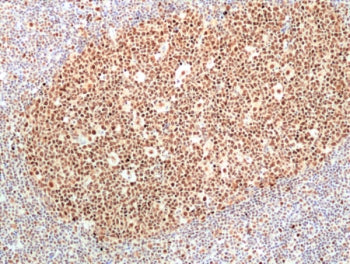 IHC staining of FFPE human tonsil tissue with recombinant Ribonuclease H2 subunit B antibody at 1:10