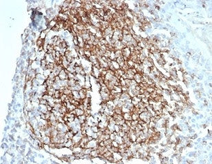 IHC staining of FFPE human kidney tissue with recombinant CD35 antibody (clone CD35/7016R) at 2ug/ml