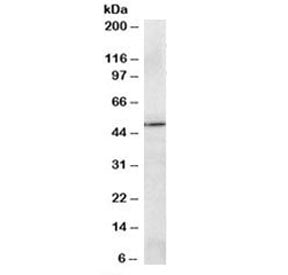 Western blot testing of A549 lysate with PRDM11 antibody at 2ug/ml. Predicted molecular weight: ~58/