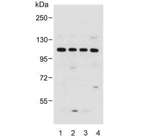 Western blot testing of human 1) HeLa, 2) MCF7, 3) SW620 and 4) A549 cell lysate with GAA antibody. 