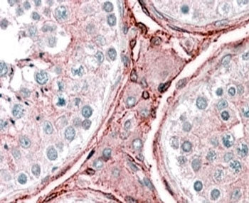 IHC testing of FFPE human testis with CYBRD1 antibody at 2.5ug/ml. HIER: steamed with pH6 citrate bu