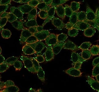 Immunofluorescent staining of PFA-fixed human HeLa cells using ERK2 antibody (green, clone PCRP-MAPK